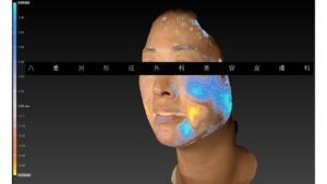 エクステンダーマスター施術前後の立体解析ボリューム変化