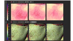 アルマバイオブーストの肌変化