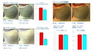 ラビアンマイルドモードの変化