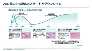 ニュービジュ注入後ダウンタイム