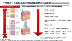 ニュービジュ注入後に起こること